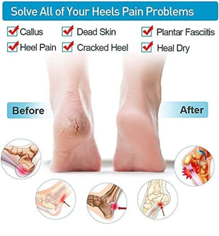 Heel repair silicon  (Super heavy quality) (Pack of 3)